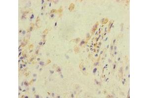 Immunohistochemistry of paraffin-embedded human placenta tissue using ABIN7157289 at dilution of 1:100 (KLHL26 抗体  (AA 366-615))