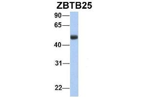 Host:  Rabbit  Target Name:  ZBTB25  Sample Type:  Human Fetal Lung  Antibody Dilution:  1. (ZBTB25 抗体  (Middle Region))