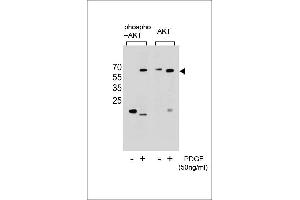 Western blot analysis of extracts from NIH-3T3 cells,untreated or treated with PDGF,using Phospho-Akt(Ser473)(left) or Akt Antibody (right). (AKT1 抗体  (pSer473))