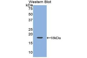 Western blot analysis of the recombinant protein. (Leptin 抗体  (AA 15-141))