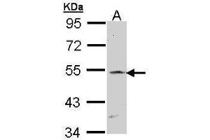 WB Image Sample (30 ug of whole cell lysate) A: Raji 7. (RBPJ 抗体)