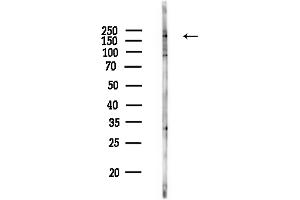 Western blot analysis of lysates from COLO205 cells(heat-shock,45 min treatment), using ABCC9 Antibody at 1/1000 dilution.