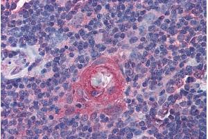 ABIN570765 (3. (ICOS 抗体  (Internal Region))