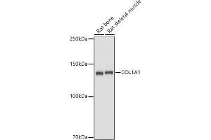 Western blot analysis of extracts of various cell lines, using Collagen I/COL1 antibody (6891) at 1:2680 dilution. (COL1A1 抗体)
