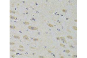Immunohistochemistry of paraffin-embedded Rat brain using RPL9 Polyclonal Antibody at dilution of 1:100 (40x lens). (RPL9 抗体)