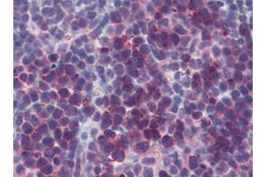 Mouse Spleen (formalin-fixed, paraffin-embedded) stained with TSLPfollowed by biotinylated goat anti-rabbit IgG secondary antibody, alkaline phosphatase-streptavidin and chromogen. (Thymic Stromal Lymphopoietin 抗体)