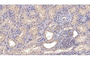 Detection of CD73 in Human Kidney Tissue using Monoclonal Antibody to Cluster Of Differentiation 73 (CD73) (CD73 抗体  (AA 29-500))