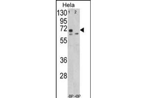 Western blot analysis of LMOD1 Antibody (Center ) (ABIN652551 and ABIN2842369) in Hela cell line lysates (35 μg/lane). (Leiomodin 1 抗体  (AA 214-241))