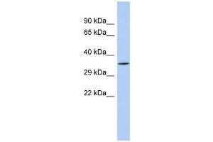SIRT4 antibody used at 0.