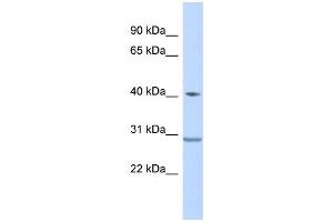 WB Suggested Anti-ZNF396 Antibody Titration:  0. (ZNF396 抗体  (Middle Region))