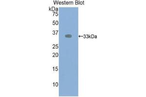 Western Blotting (WB) image for anti-VEGF Receptor 2 (VEGFR2) (AA 46-320) antibody (ABIN1078658)