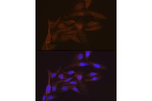 Immunofluorescence analysis of U-2 OS cells using SMC4 Rabbit mAb (ABIN7270618) at dilution of 1:100 (40x lens). (SMC4 抗体)