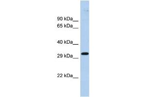 Host:  Rabbit  Target Name:  ZNF397  Sample Type:  Fetal Brain lysates  Antibody Dilution:  1. (ZNF397 抗体  (Middle Region))