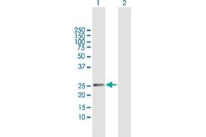 Western Blot analysis of CSN1S1 expression in transfected 293T cell line by CSN1S1 MaxPab polyclonal antibody. (Casein alpha S1 抗体  (AA 1-185))