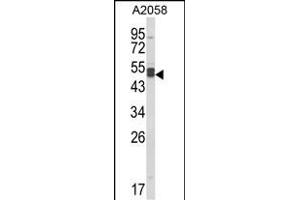Western blot analysis of AGT3 Antibody (Center) (ABIN652630 and ABIN2842420) in  cell line lysates (35 μg/lane). (AGPAT3 抗体  (AA 241-269))