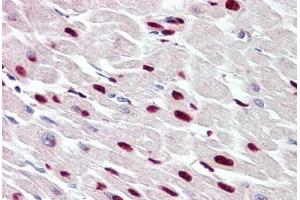 Image no. 2 for anti-THAP Domain Containing 5 (THAP5) (AA 203-252) antibody (ABIN6749756) (THAP5 抗体  (AA 203-252))