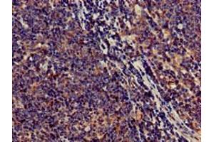 Immunohistochemistry of paraffin-embedded human lymph node tissue using ABIN7170561 at dilution of 1:100 (SAMD8 抗体  (AA 1-152))