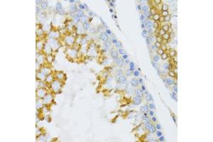 Immunohistochemistry of paraffin-embedded mouse testis using PTN Antibody (ABIN3017413, ABIN3017414, ABIN1682388 and ABIN6220085) at dilution of 1:100 (40x lens). (Pleiotrophin 抗体)