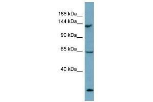 LATS1 antibody used at 1 ug/ml to detect target protein. (LATS1 抗体)