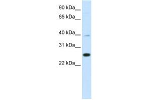 WB Suggested Anti-YAF2 Antibody Titration:  0. (YAF2 抗体  (Middle Region))