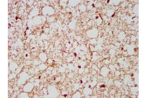 IHC image of ABIN7161257 diluted at 1:500 and staining in paraffin-embedded human brain tissue performed on a Leica BondTM system. (NCDN 抗体  (AA 403-516))