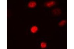 Immunofluorescent analysis of SAMHD1 staining in MCF7 cells. (SAMHD1 抗体)