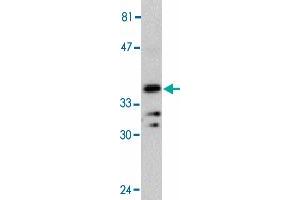 Western blot analysis of MYD88 in Jurkat whole cell lysate with MYD88 polyclonal antibody  at 1 : 500 dilution. (MYD88 抗体  (AA 233-248))