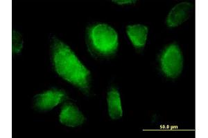 Immunofluorescence of purified MaxPab antibody to RHOQ on HeLa cell. (RHOQ 抗体  (AA 1-205))