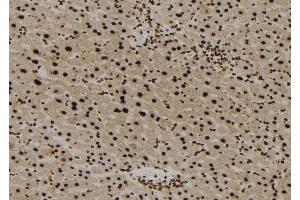 ABIN6277280 at 1/100 staining Mouse liver tissue by IHC-P.