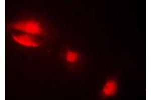 Immunofluorescent analysis of Cytokeratin 14 staining in MCF7 cells. (KRT14 抗体  (N-Term))