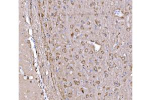 IHC analysis of PAK1 using anti-PAK1 antibody (ABIN7599852).