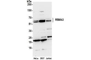 Western Blotting (WB) image for anti-RNA Binding Motif Protein 42 (RBM42) (AA 430-480) antibody (ABIN7450643) (RBM42 抗体  (AA 430-480))