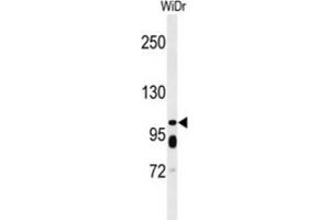 Western Blotting (WB) image for anti-ATP-Binding Cassette, Sub-Family C (CFTR/MRP), Member 11 (ABCC11) antibody (ABIN5021768) (ABCC11 抗体)
