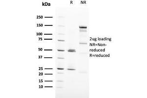 SDS-PAGE Analysis Purified HER-2 Monospecific Mouse Monoclonal Antibody (ERBB2/3093). (ErbB2/Her2 抗体  (AA 311-462))