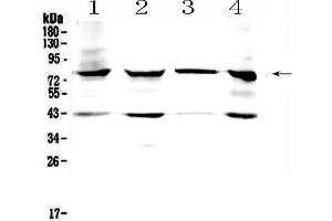 Western blot analysis of HSD17B4 using anti- HSD17B4 antibody .