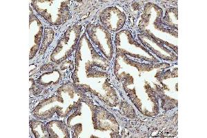IHC analysis of GSDMD using anti-GSDMD antibody (ABIN7599431).