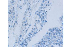 Immunohistochemistry (IHC) image for anti-Nephrosis 1, Congenital, Finnish Type (Nephrin) (NPHS1) antibody (ABIN1873932) (Nephrin 抗体)