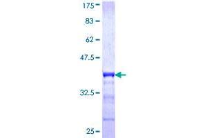 Uroplakin 1B Protein (UPK1B) (AA 131-228) (GST tag)