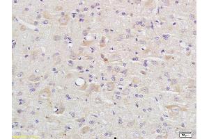 Formalin-fixed and paraffin embedded rat brain labeled with Anti Caspase-9 p10 Polyclonal Antibody, Unconjugated (ABIN1387603) at 1:200 followed by conjugation to the secondary antibody and DAB staining (Caspase 9 抗体  (AA 351-416))