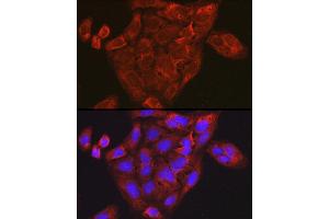 Immunofluorescence analysis of U-2 OS cells using CCL3 Rabbit pAb (ABIN6130184, ABIN6138061, ABIN6138062 and ABIN6223474) at dilution of 1:100 (40x lens). (CCL3 抗体  (AA 24-92))