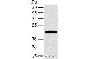 Western blot analysis of A375 cell, using MAGEA10 Polyclonal Antibody at dilution of 1:400 (MAGEA10 抗体)