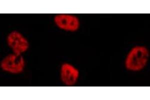 ABIN6276705 staining  Hela cells by IF/ICC. (RENT1/UPF1 抗体)