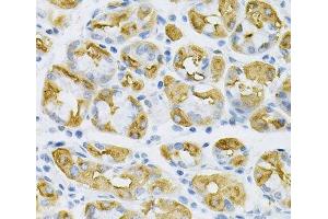 Immunohistochemistry of paraffin-embedded Human stomach using SDC4 Polyclonal Antibody at dilution of 1:100 (40x lens). (SDC4 抗体)