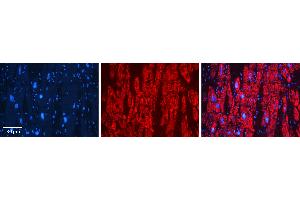 Rabbit Anti-GSTA4 Antibody   Formalin Fixed Paraffin Embedded Tissue: Human heart Tissue Observed Staining: Cytoplasmic Primary Antibody Concentration: N/A Other Working Concentrations: 1:600 Secondary Antibody: Donkey anti-Rabbit-Cy3 Secondary Antibody Concentration: 1:200 Magnification: 20X Exposure Time: 0. (GSTA4 抗体  (C-Term))