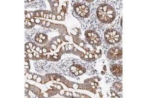 Immunohistochemical staining of human small intestine with MRPL37 polyclonal antibody  shows moderate granular positivity in glandular cells.