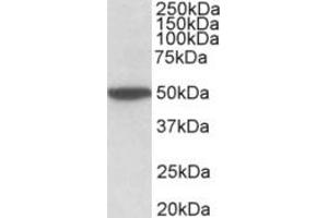 Western Blotting (WB) image for anti-Cholinergic Receptor, Muscarinic 2 (CHRM2) (Internal Region) antibody (ABIN2465137) (Muscarinic Acetylcholine Receptor M2 抗体  (Internal Region))