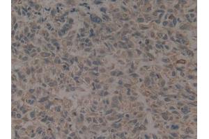 Immunohistochemistry (IHC) image for anti-Keratin 16 (KRT16) (AA 117-419) antibody (ABIN1172993)