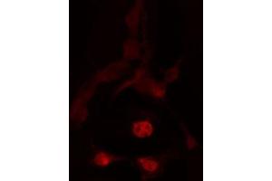 ABIN6272442 staining HeLa by IF/ICC. (TBX2 抗体  (C-Term))