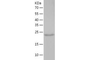 Syntaxin 17 Protein (STX17) (AA 1-229) (His tag)