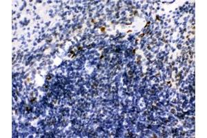 IHC testing of FFPE mouse spleen with IKAROS antibody. (IKZF1 抗体)